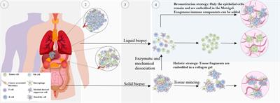 Toward reproducible tumor organoid culture: focusing on primary liver cancer